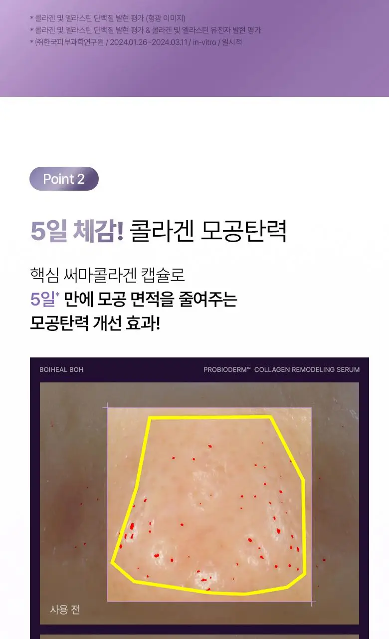 [모공고민] 바이오힐보 프로바이오덤 콜라겐 리모델링 세럼 30ml 더블기획 상세페이지 22
